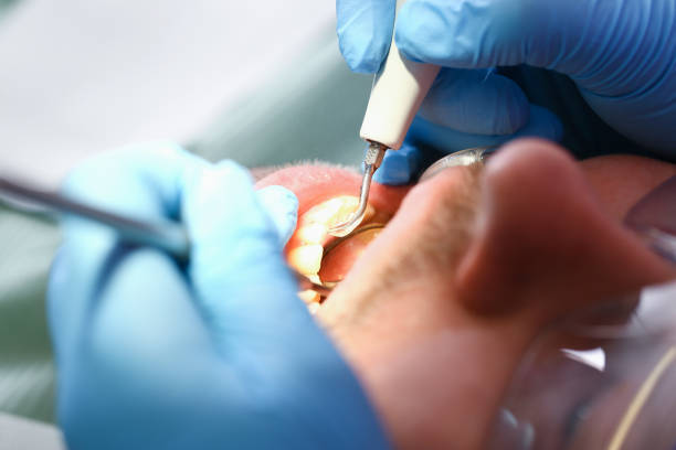 Best Weekend Emergency Dentist in Noroton Heights, CT