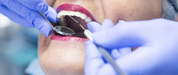 Best Emergency Treatment for Dental Infections or Abscesses in Noroton Heights, CT